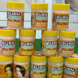 Burn Remover Face Cream