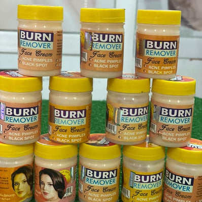 Burn Remover Face Cream