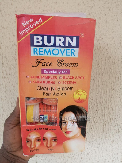 Burn Remover Face Cream