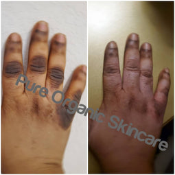 Pure organic skincare dark knuckle remover