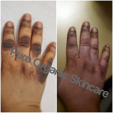 Pure organic skincare dark knuckle remover