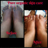 Pure organic skincare dark knuckle remover