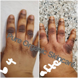 Pure organic skincare dark knuckle remover