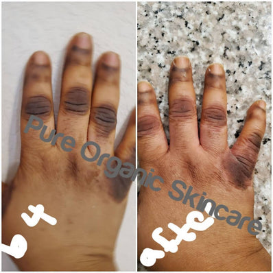 Pure organic skincare dark knuckle remover