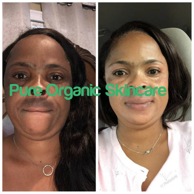 Pure Organic Skin Care – Dark Spot Corrector Serum (50ml)