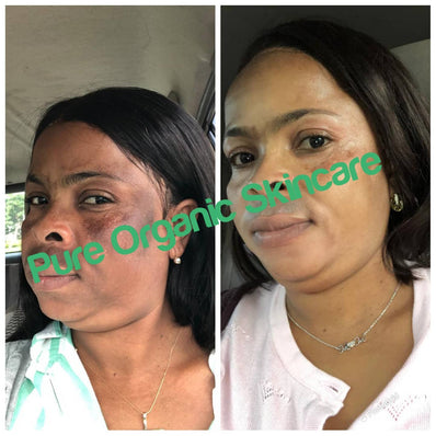 Pure Organic Skin Care – Supreme Whitening Face Cream