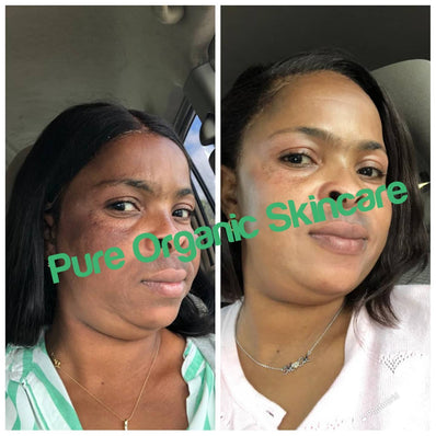 Pure Organic Skin Care – Supreme Whitening Face Cream